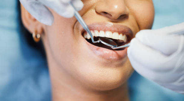 Best Broken or Chipped Tooth Repair in Mesa, AZ